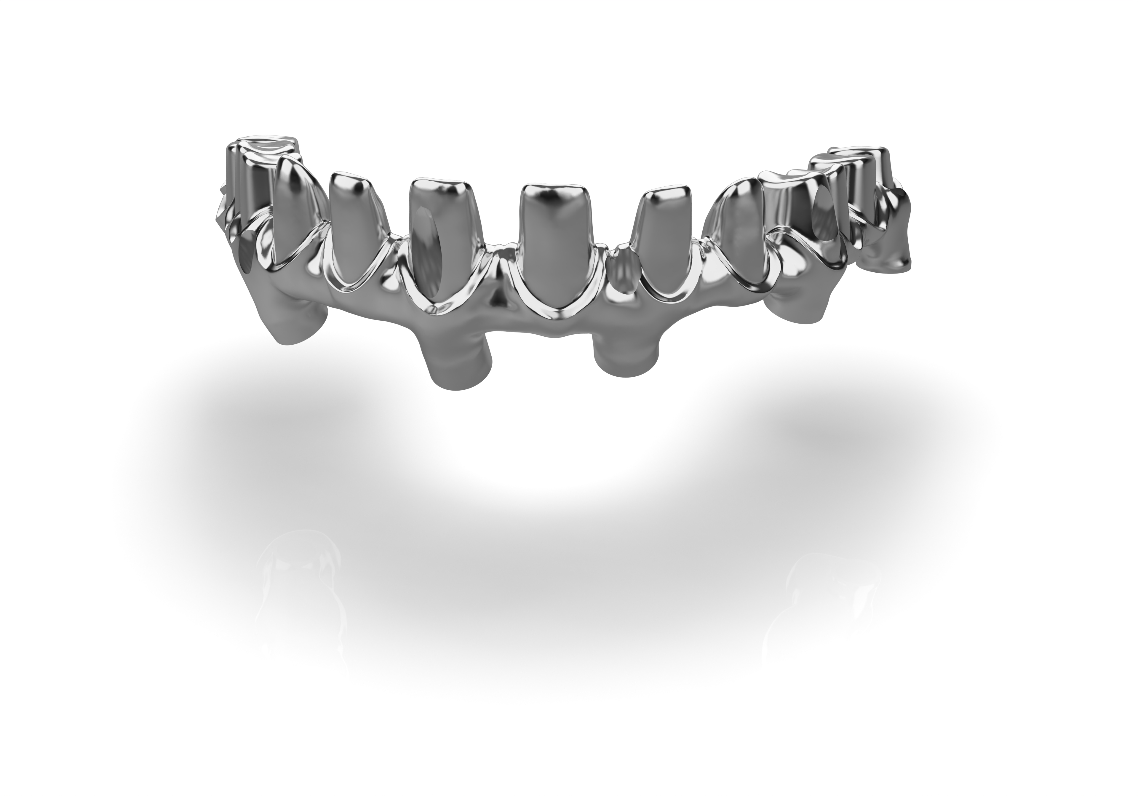 implant milled titanium framework for All on X and denture restorations