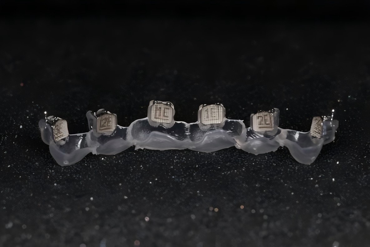 Indirect Bonding Tray