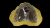 Metal Brackets