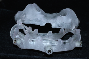 Digital Guided Surgery