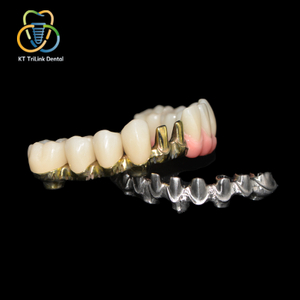 Implant-Supported Malo Bridge with Individual Ceramic Crowns
