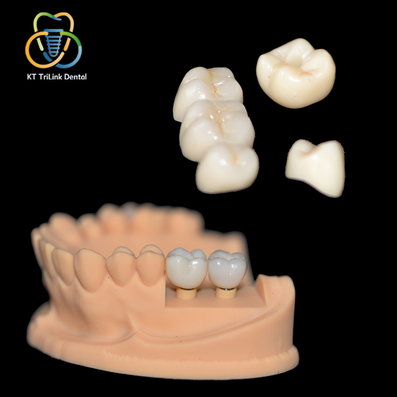 Zirconia All‑ceramic Crown