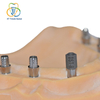 Implant Mono Scanbody Compatible with Osstem