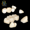 Zirconia All‑ceramic Crown