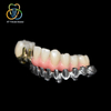 Implant-Supported Malo Bridge with Individual Ceramic Crowns