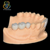 Zirconia All‑ceramic Crown