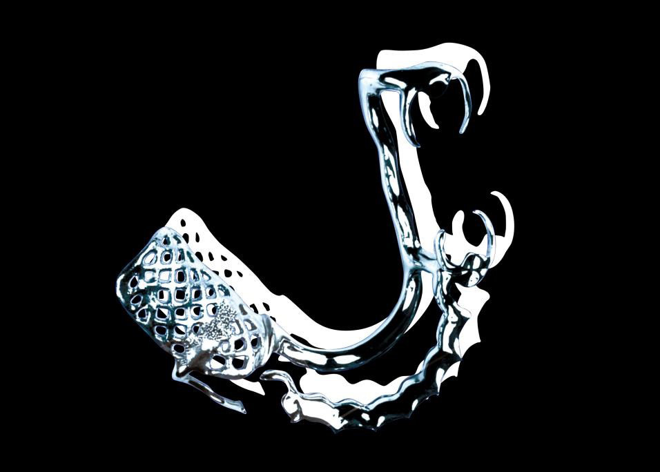 Metal Brackets