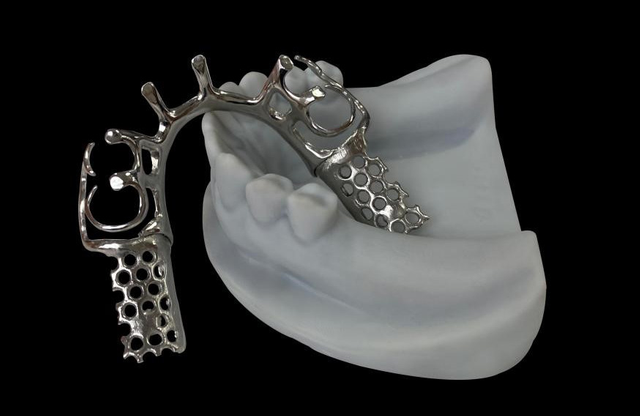 Metal Brackets