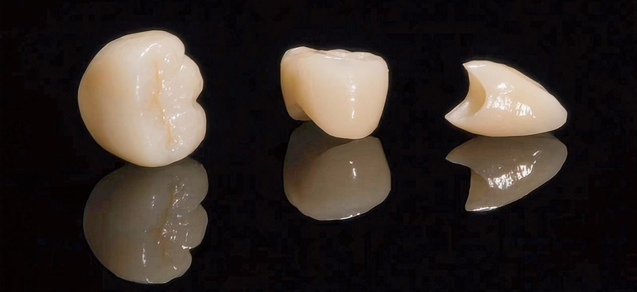 All-Ceramic &Zirconia Crowns