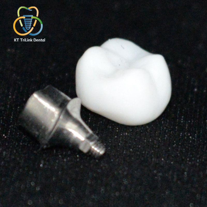 Implant-Supported Full-Contour Multilayer Zirconia Crown